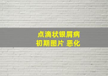 点滴状银屑病初期图片 恶化